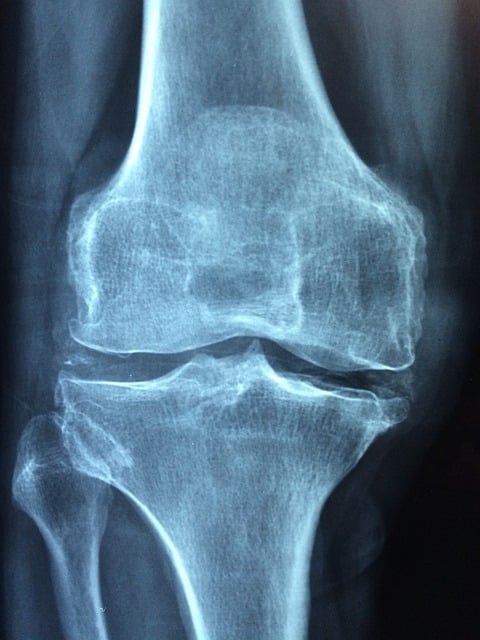 Huile de CBD pour l'ostéoporose